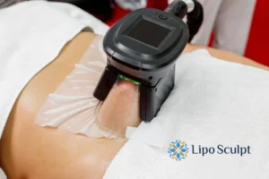 Cryolipolysis Helping You Getting that Perfect Summer Body 3 Cryolipolysis Wiltshire can give you the best summer body - contact us today!