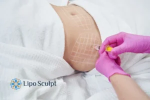Are The Results From Aqualyx Permanent? 1 Do you want to know how long Aqualyx Wiltshire results last?
