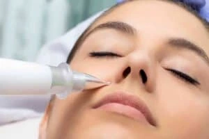 Best Actinic Keratoses Removal 3 Actinic keratoses Wiltshire solutions - book in today!
