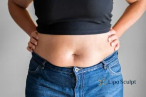 Bidding Farewell to Muffin Tops with Aqualyx Fat Injections 2 Do you wish you could reduce your muffin top Wiltshire With Aqualy fat dissolving injections you can!